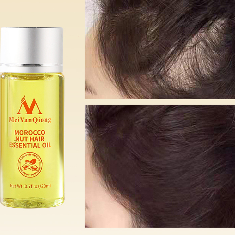 Hair Care Fragrance Essential Oil - 20ML Essential Oil for Hair Growth