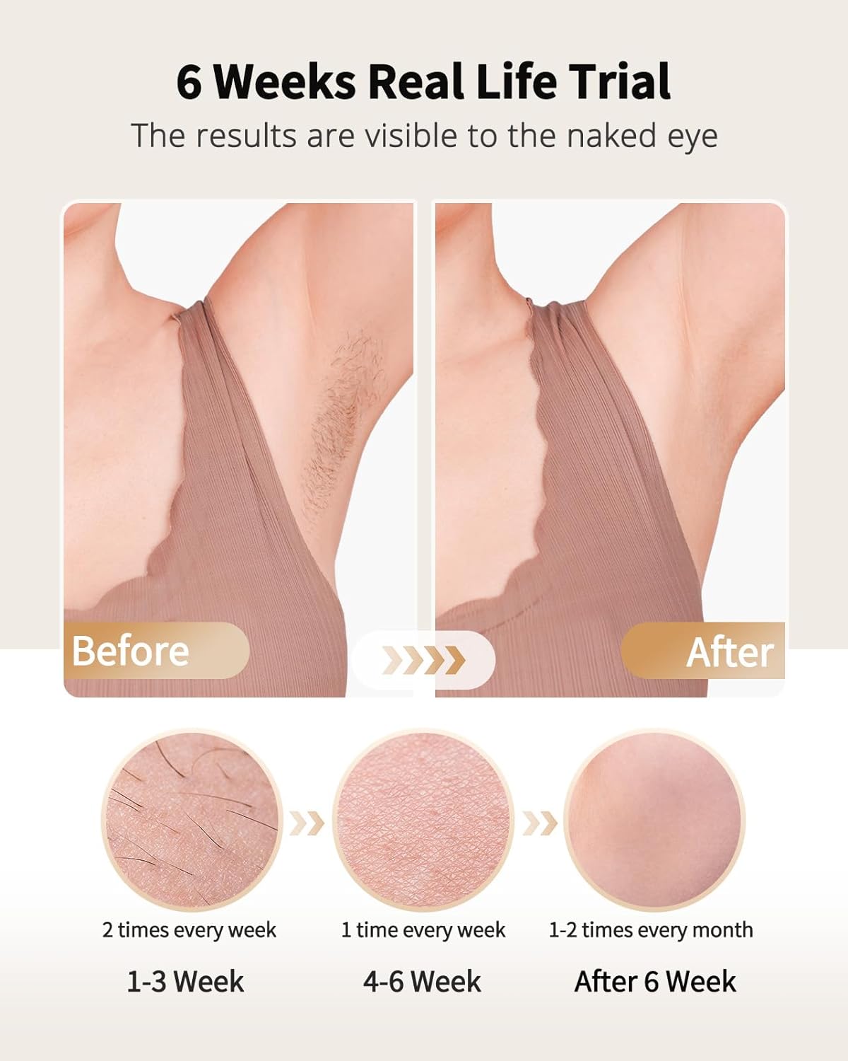 Laser Hair Removal with Ice Co - Hair Care Or Haircare avaliação e preço