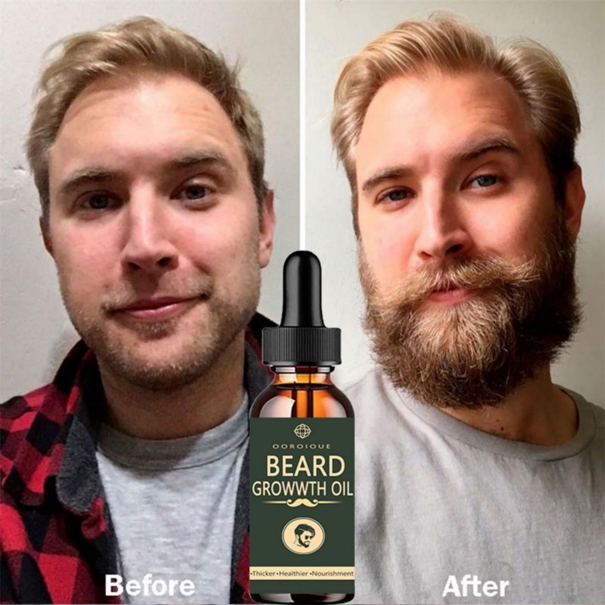 Fast Beard Growth Oil Beard Oi - Caffeine Hair Serum avaliação e preço