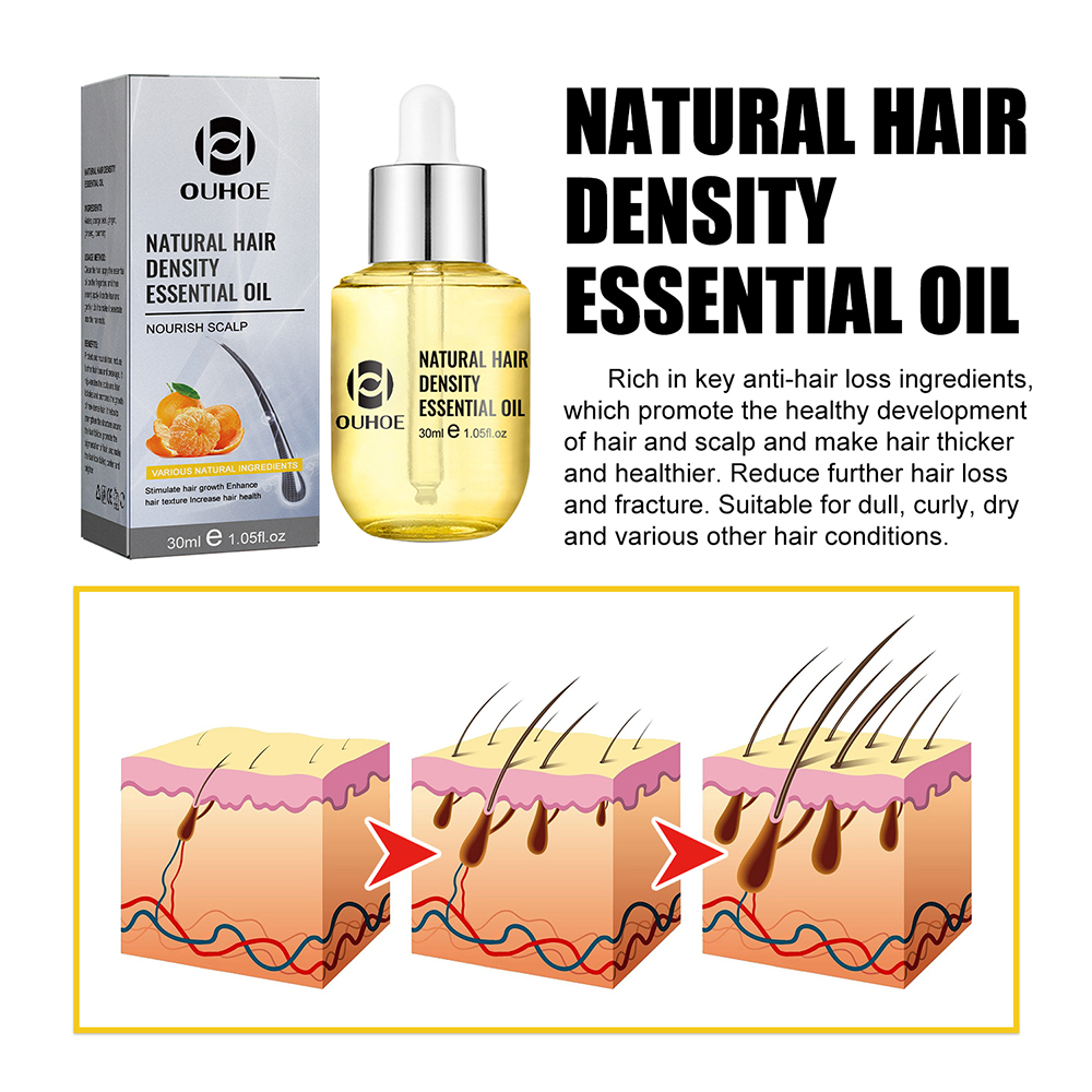 1/2PCS Ginger Hair Growth Oil  - Hair Care Ginseng avaliação e preço
