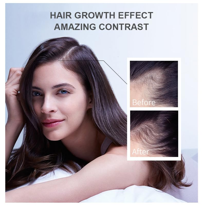 Hair Growth Oil Ginger Biotin  - Hair Care Fragrance Essential Oil avaliação e preço