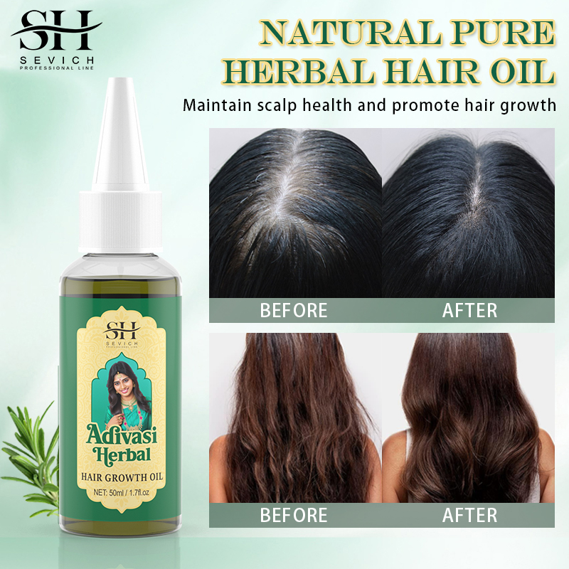 Ayurvedic Hair Growth Oil Adiv - Caffeine Hair Serum avaliação e preço