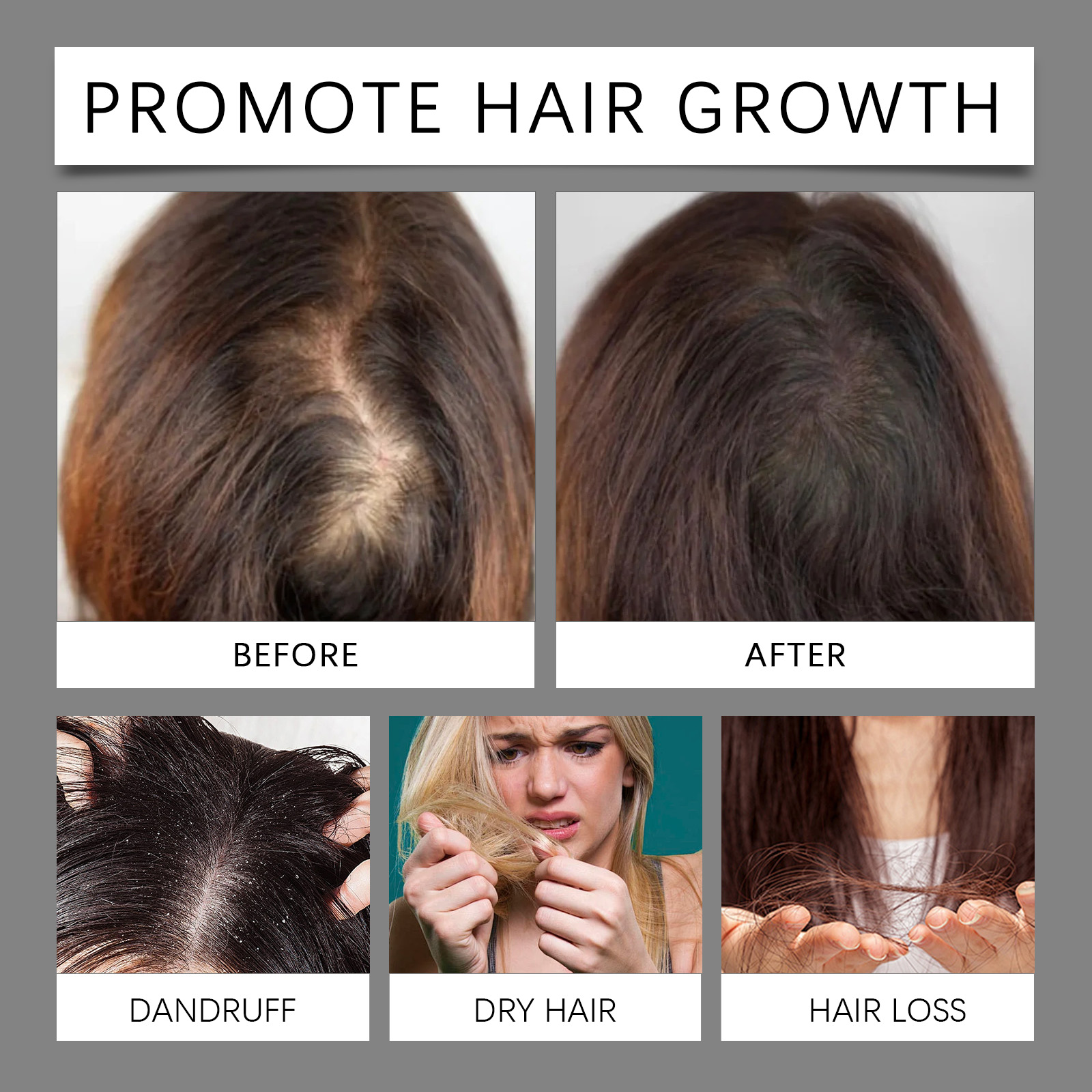30ml Hair Care Essential Oil T - Hair Growth Serum Oil avaliação e preço