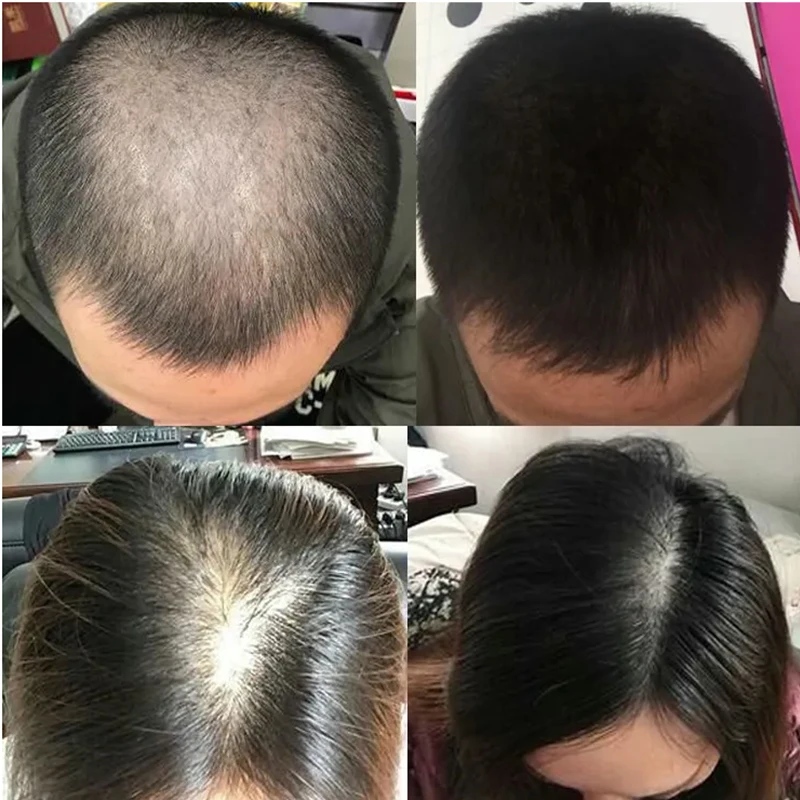 Overlord plant hair growth liq - Hair Care Or Haircare avaliação e preço