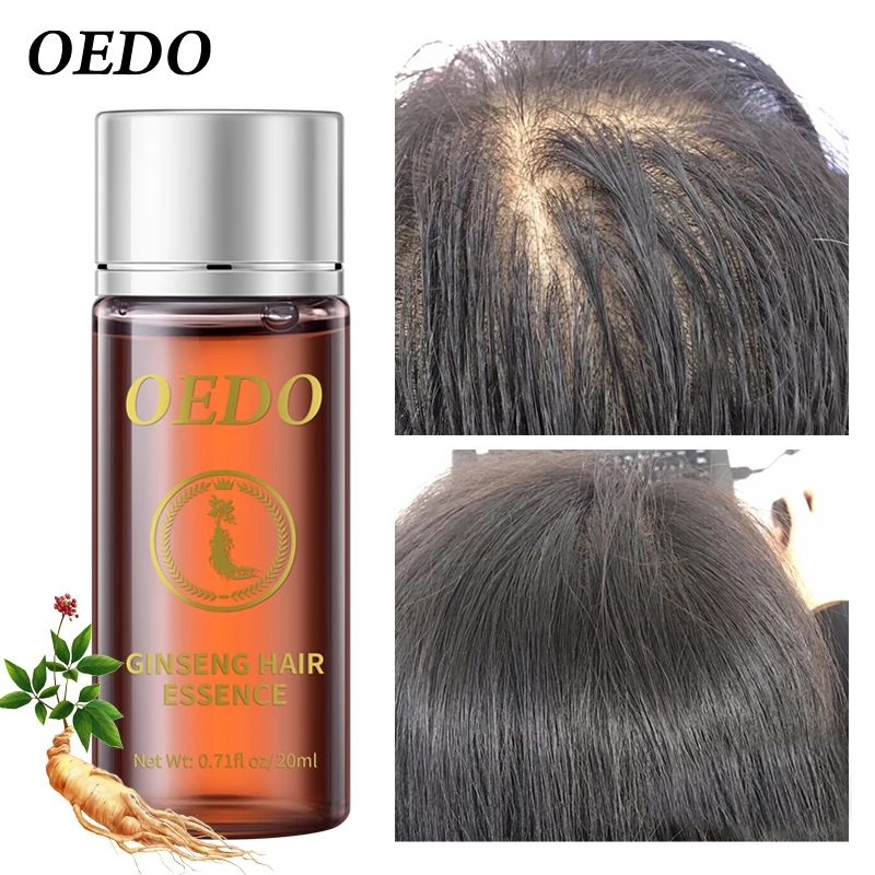 20ML Ginseng Hair Growth Essen - Hair Care Ginseng avaliação e preço