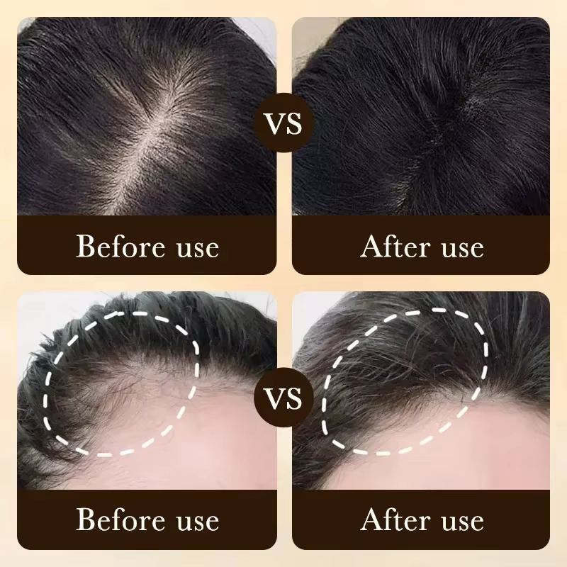 One-stop hair care: Solve basi - Hair Care Basic avaliação e preço