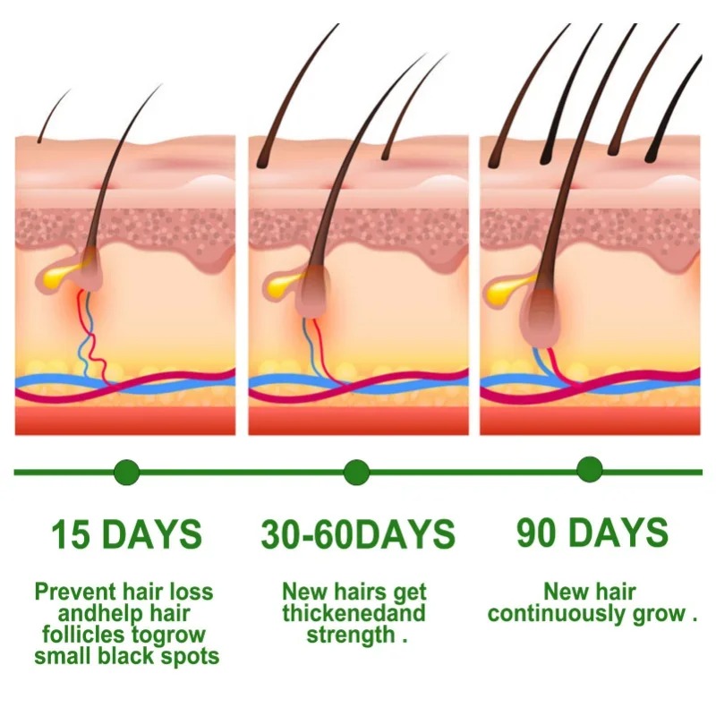 Hair Growth Serum Fast Growing - Caffeine Hair Serum avaliação e preço