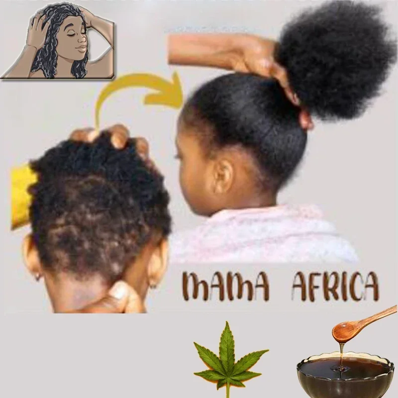Africa Women Traction Alopecia - Hair Care Ginseng avaliação e preço