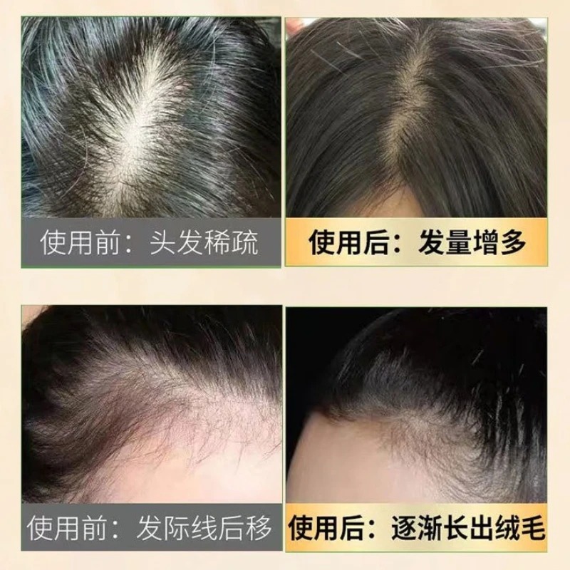 Natural Ginseng Hair Loss Care - Hair Care Ginseng avaliação e preço