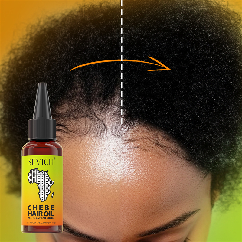 Chebe Fast Hair Growth Oil Afr - Hair Care Fragrance Essential Oil avaliação e preço
