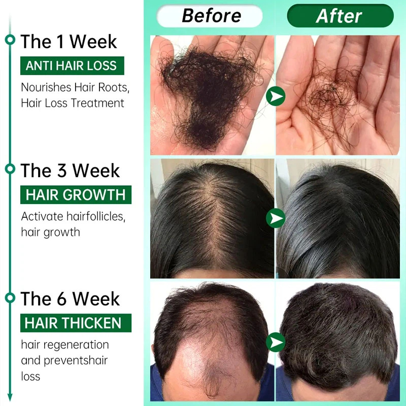 7 Days Fast Grow Hair Growth S - Caffeine Hair Serum avaliação e preço