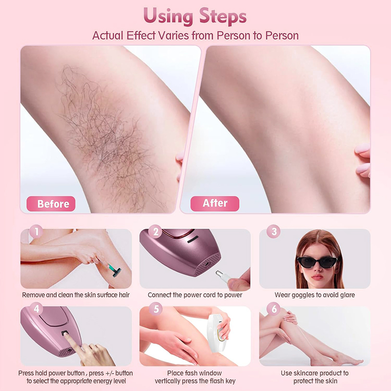 IPL laser Hair Remover Hair Cu - Hair Care Or Haircare avaliação e preço
