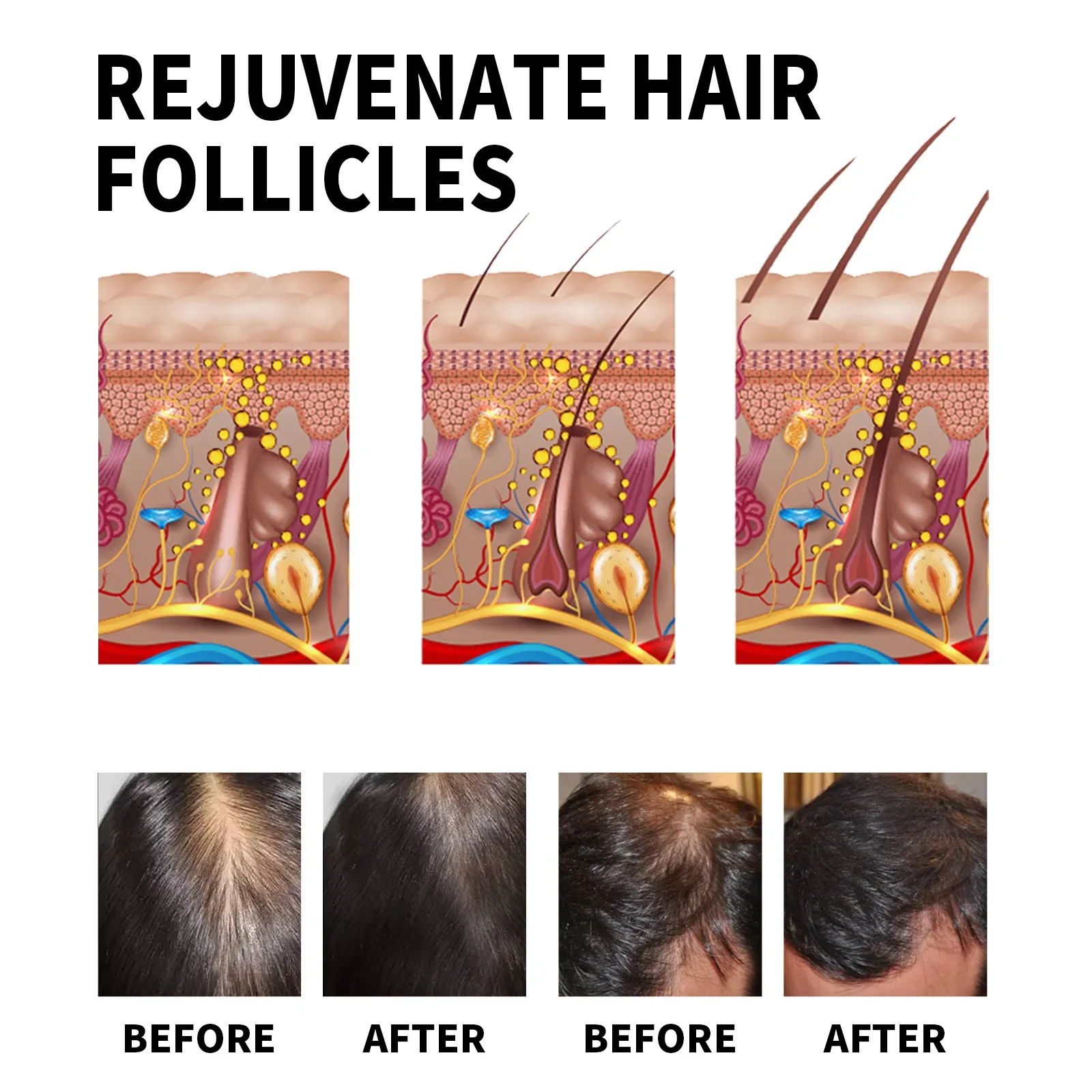 Ginger Hair Growth Products Fa - Hair Care Fragrance Essential Oil avaliação e preço