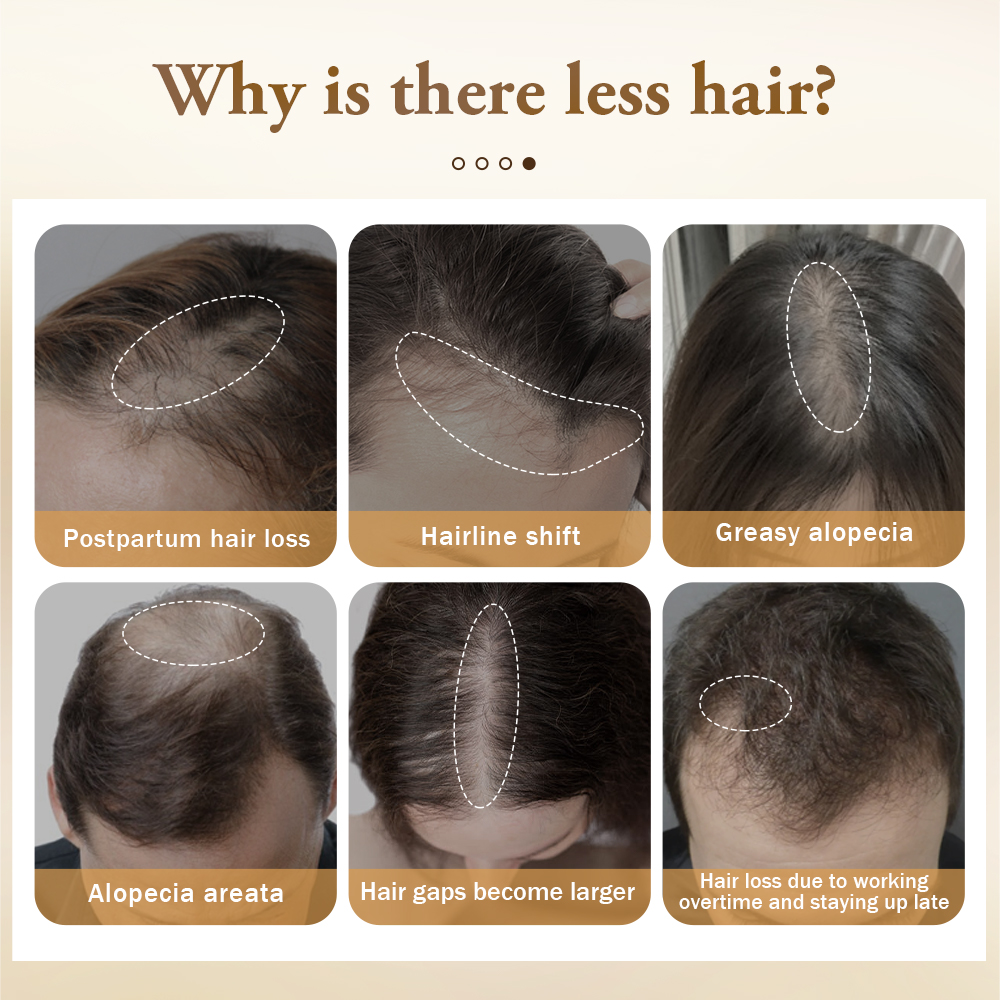 PURC Hair Growth Products for  - Hair Care Ginseng avaliação e preço