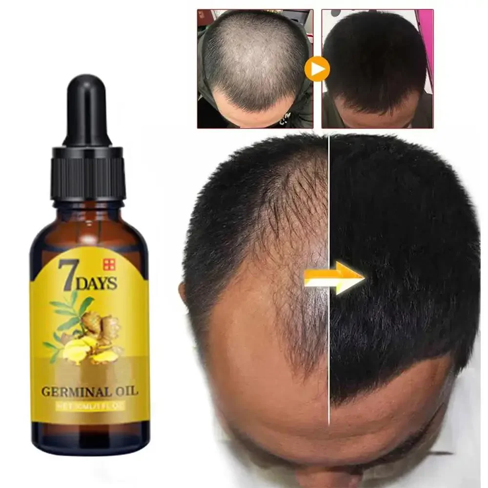 Hair Growth Ginger Fast Growin - Caffeine Hair Serum avaliação e preço