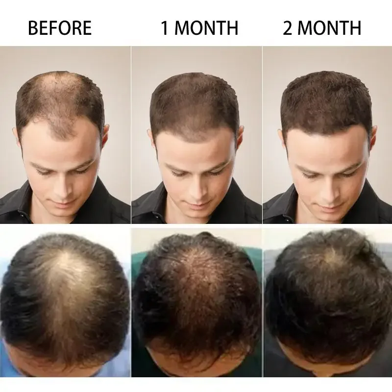 Hair Growth Ginger Fast Growin - Caffeine Hair Serum avaliação e preço