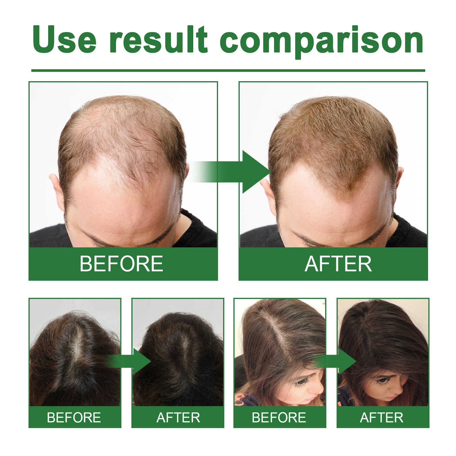 Rosemary Spray for Hair Nouris - Hair Care Growth avaliação e preço