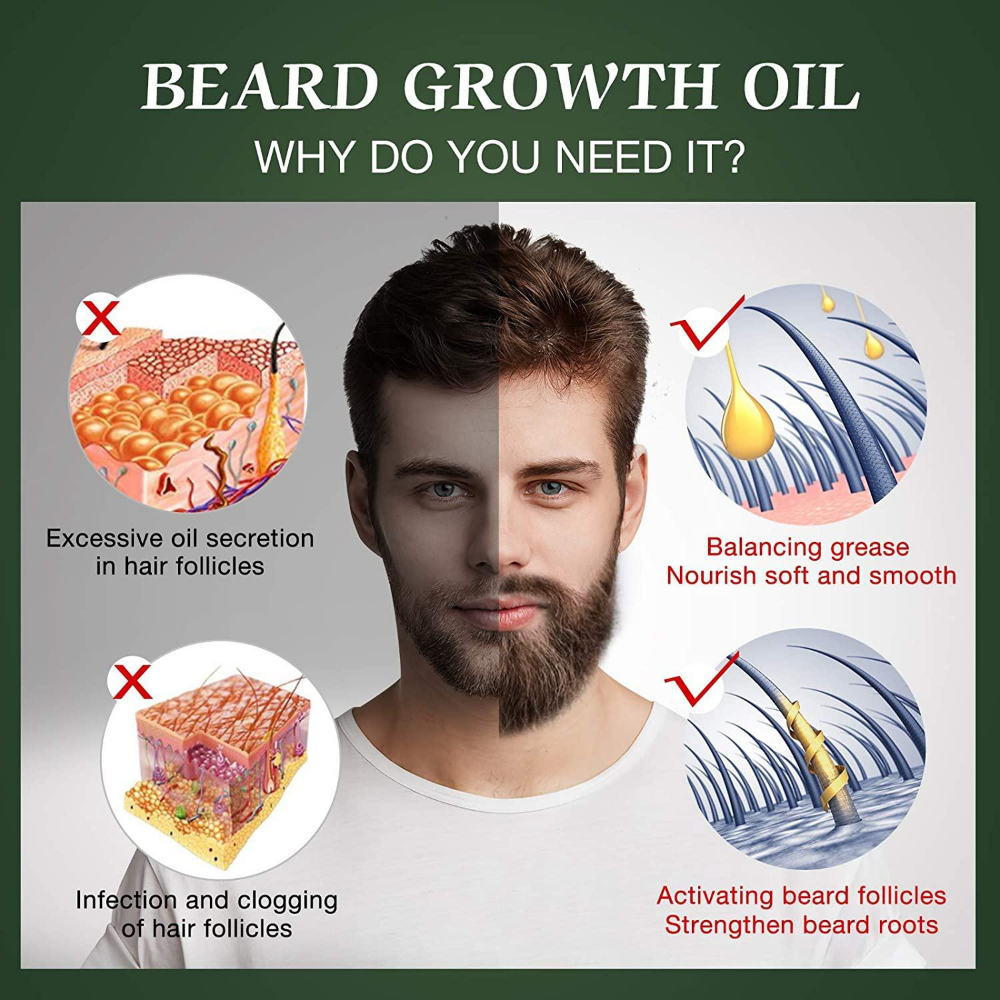 Fast Beard Growth Oil Beard Oi - Hair Care Fragrance Essential Oil avaliação e preço