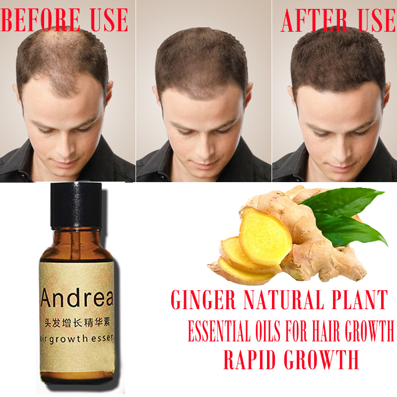 2/5/10Pcs Andrea Hair Growth S - Hair Care Fragrance Essential Oil avaliação e preço