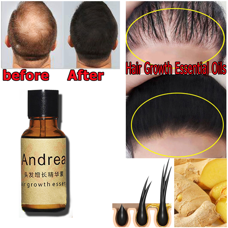 2/5/10Pcs Andrea Hair Growth S - Hair Care Fragrance Essential Oil avaliação e preço