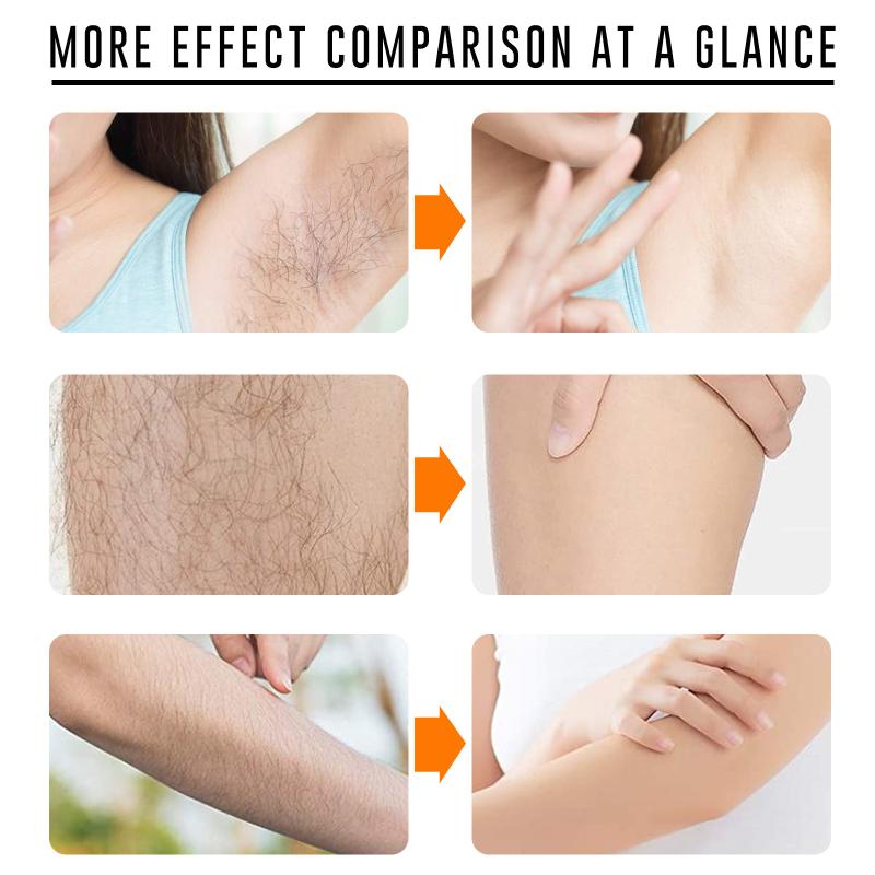 Fast Hair Removal Spray Painle - Hair Care Women avaliação e preço