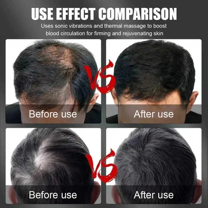 660nm 850nm Red Light Infrared - Hair Care Growth avaliação e preço